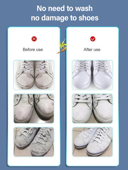 Stain Removal & Whitening Shoe Shine